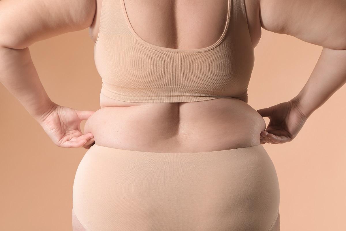 ¿Qué relación existe entre las hormonas y la obesidad?