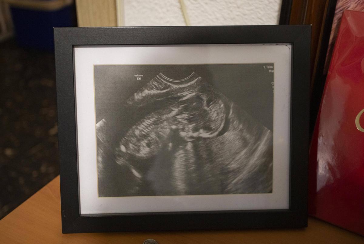 La ultima ecografía de Escarlett, la víctima de la dana que no llegó a nacer.