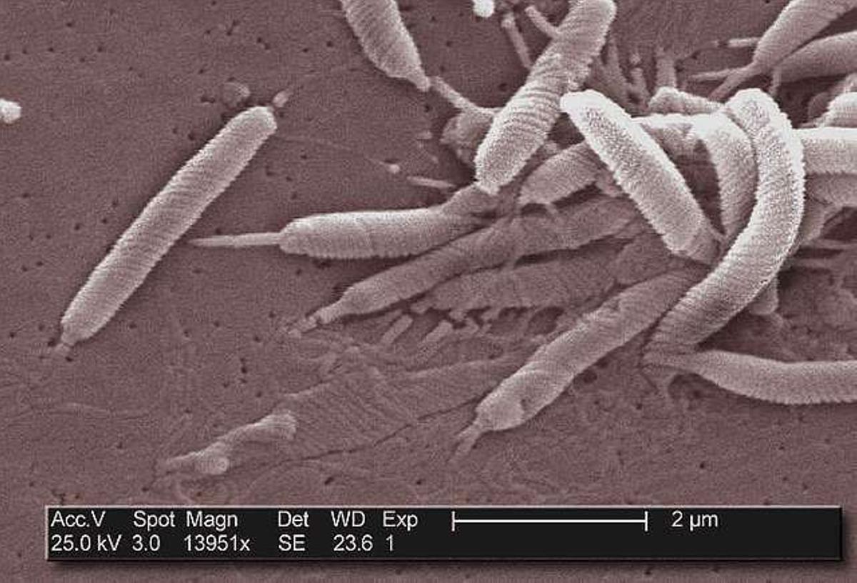 Helicobacter pylori, quizás la bacteria más presente en el mundo