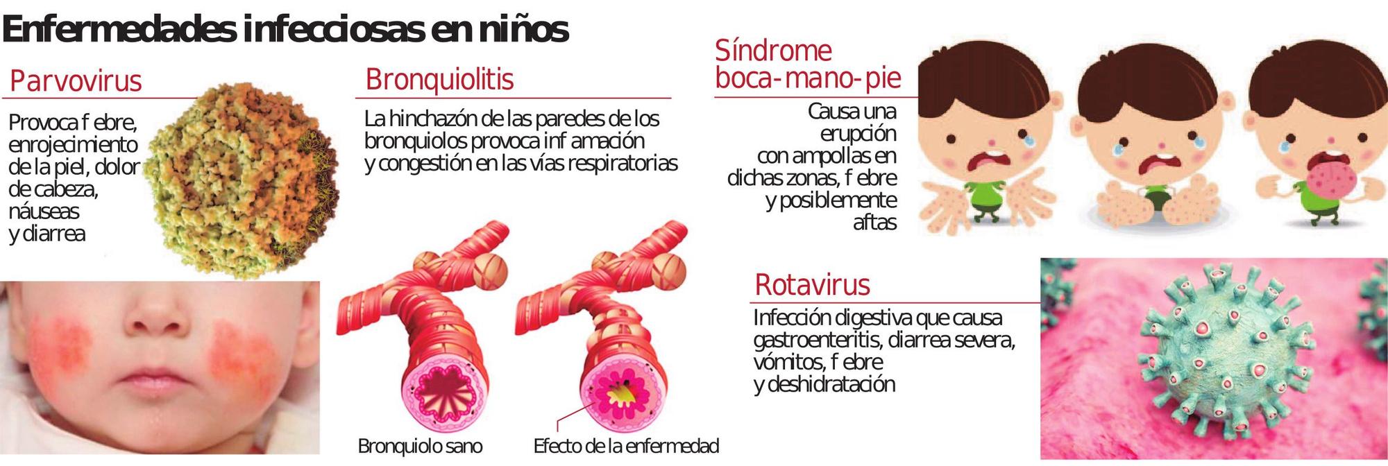 Principales enfermedades infecciosas en niños.