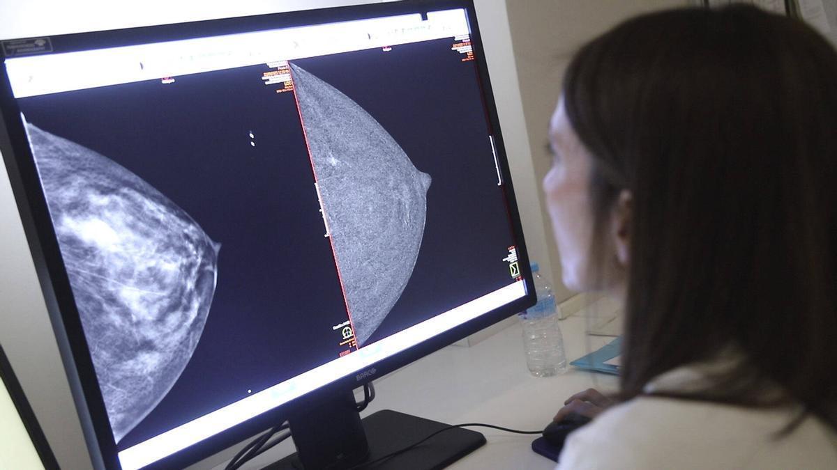 La especialista en Radiodiagnóstico del hospital Reina Sofía, Sara Romero, estudia una mamografía.