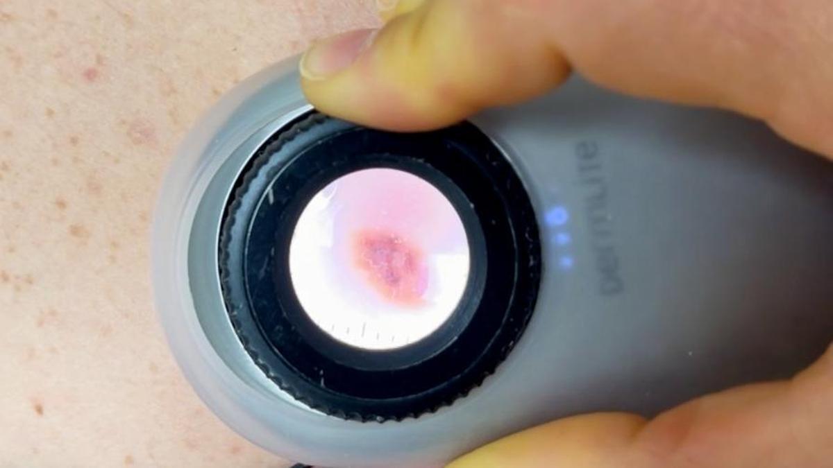 Euromelanoma 2026