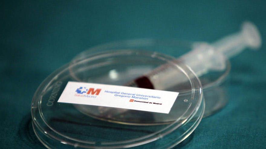 Aspecto del primer gel microbicida en el mundo que podría prevenir la transmisión del virus VIH