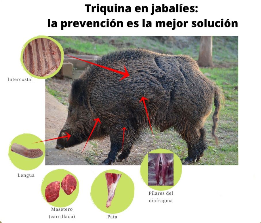 La triquinosis es una enfermedad parasitaria que afecta a los humanos