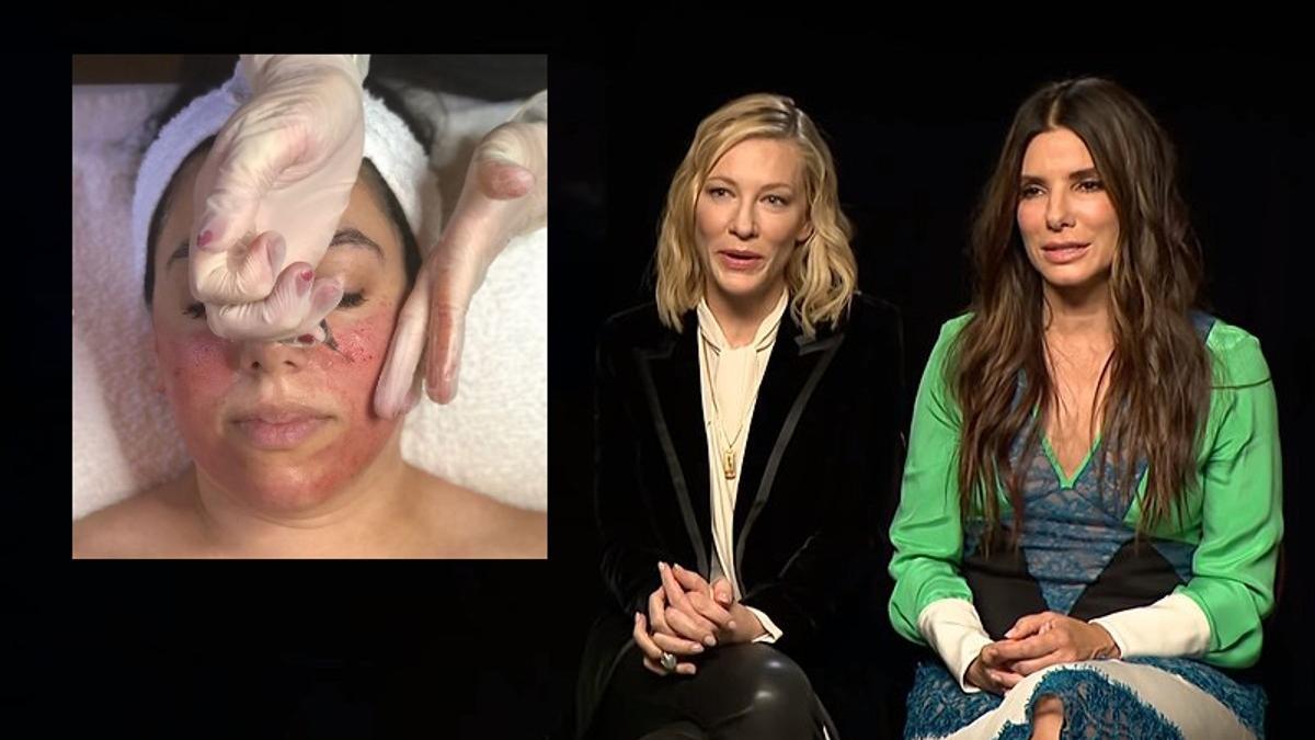 Cate Blanchett y Sandra Bullock, las dos estrellas que popularizaron el &quot;facial de pene&quot;, junto a una imagen de una intervención del mismo