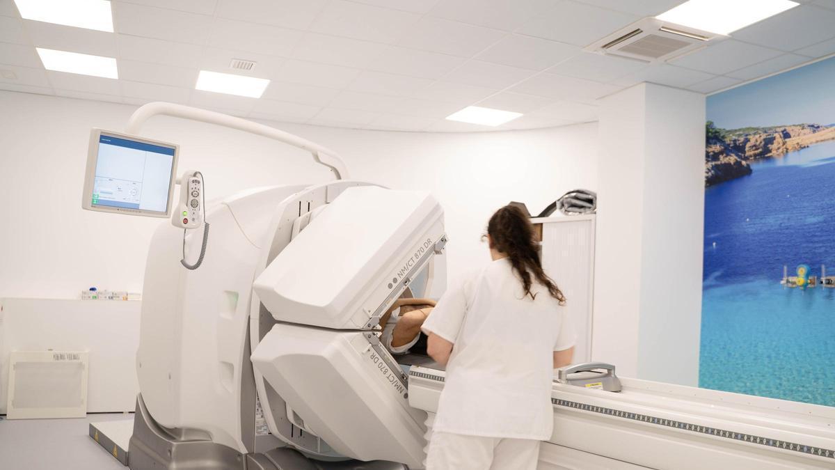 El SPECT miocárdico, una prueba avanzada de imagen utilizada en cardiología y medicina nuclear.