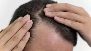 Di adiós a la caída del pelo con el artículo más eficaz según los expertos
