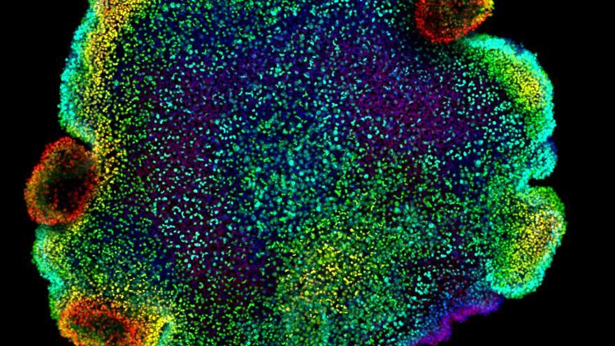 Animales del tamaño de un grano de arena formaron las primeras neuronas hace 800 millones de años