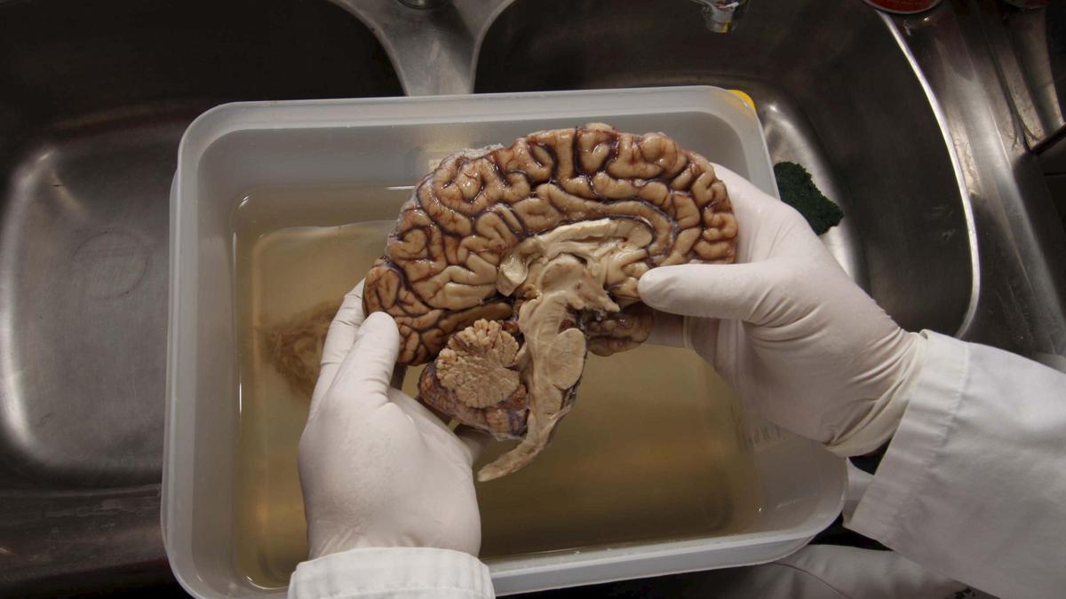 ALZHÉIMER INVESTIGACIÓN | El alzhéimer más allá de la genética: «Hay células del sistema inmune que juegan un papel importante en esta demencia»