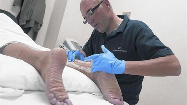 MASAJE FISIOTERAPÉUTICO. Huélamo aplica una friega en la zona afectada por una tendinitis de Aquiles posquirúrgica.
