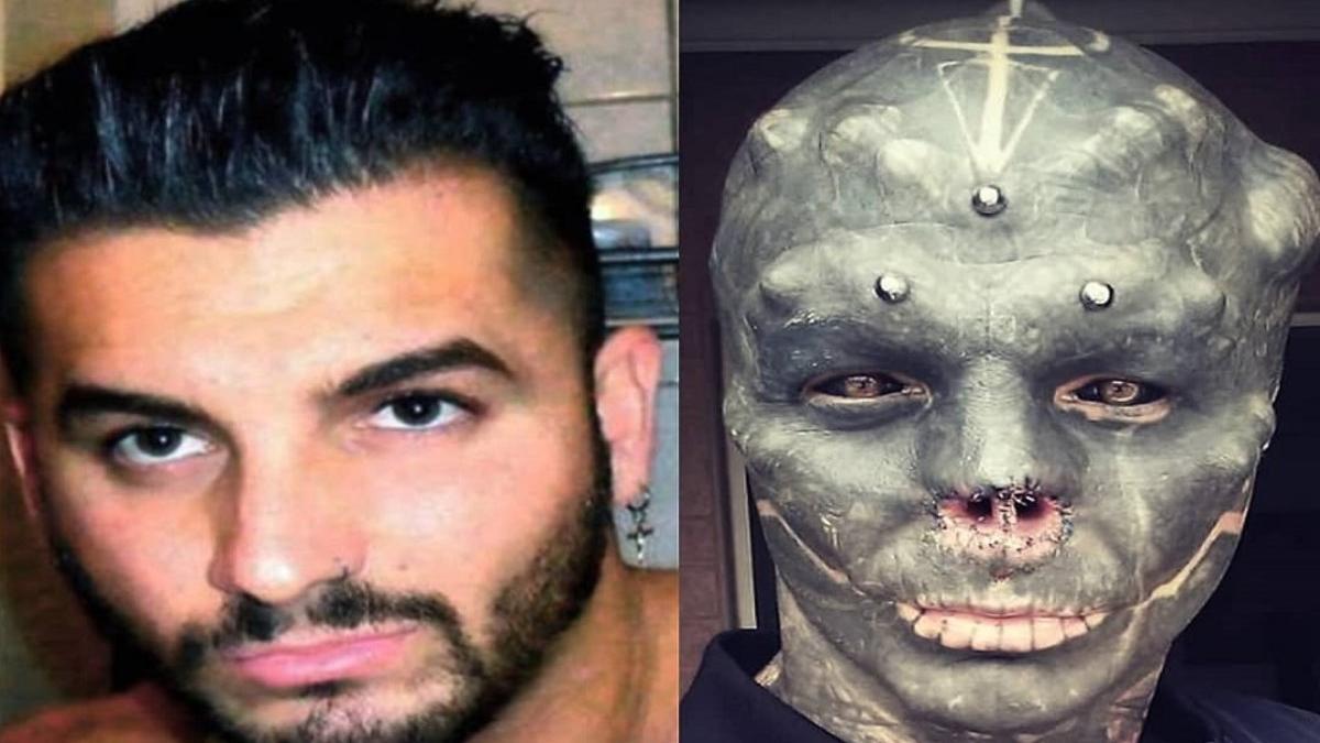 Un hombre se opera nariz y lengua como parte de su transformación en alien