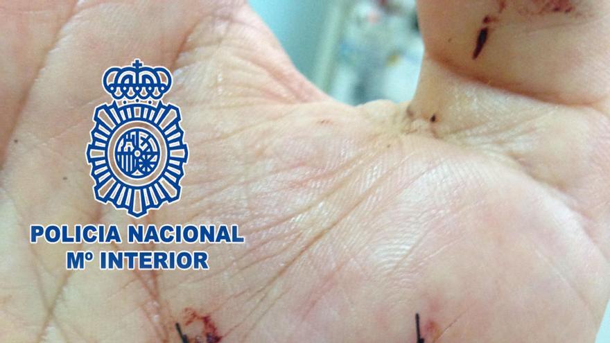 El agente ha resultado herido en una mano