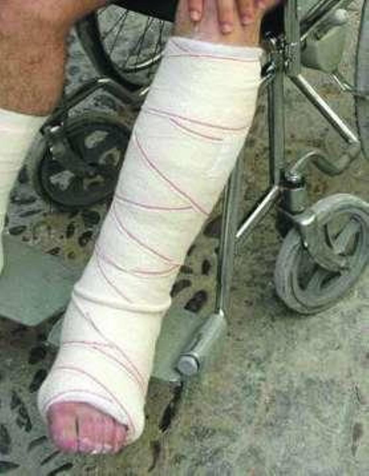 La lesión. diario información