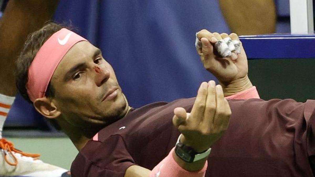 Nadal se duele de la nariz tras el golpe