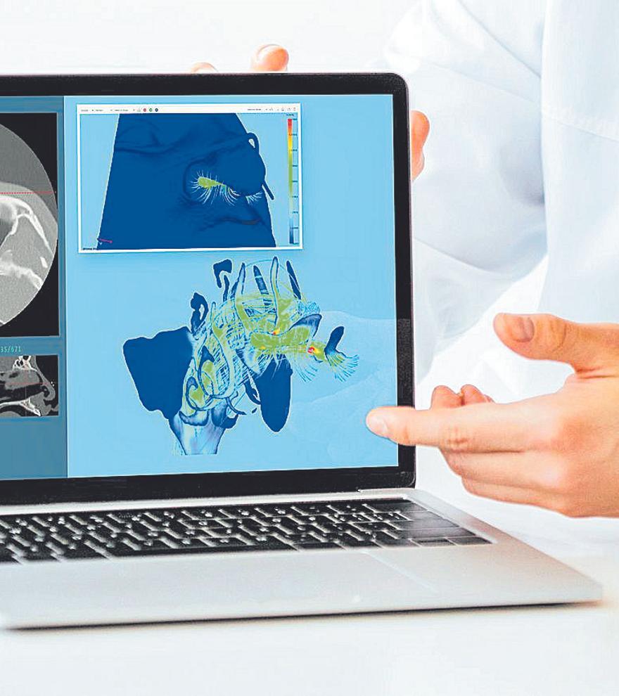 Un salto de gigante en el diagnóstico y cirugía nasal