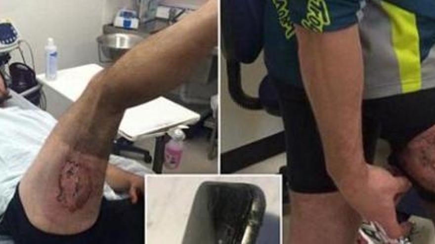 Un ciclista pateix cremades en explotar-li el seu iPhone