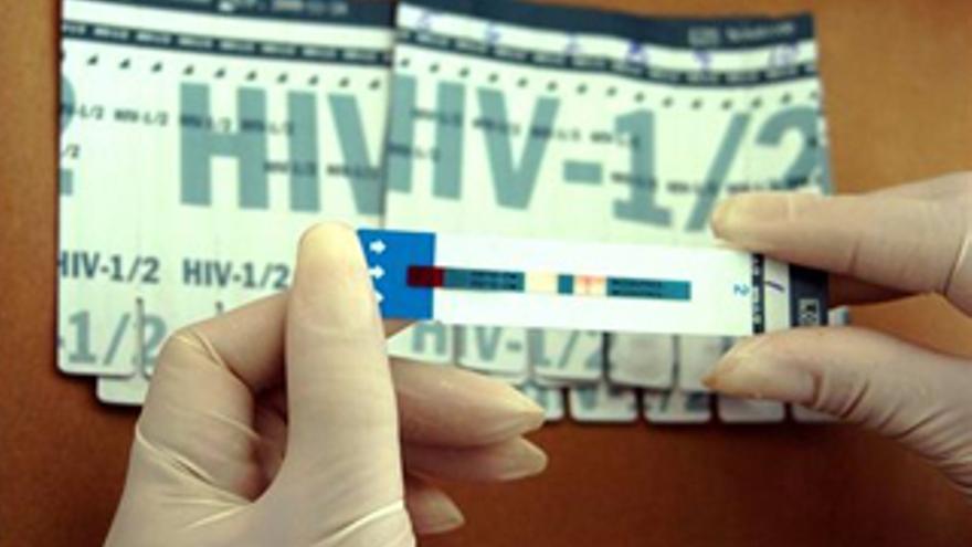 Cataluña obligará a declarar las infecciones por VIH a partir de 2009