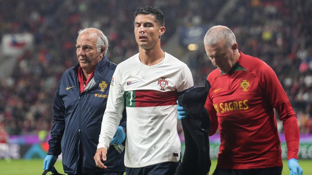 Cristiano Ronaldo, con el rostro magullado