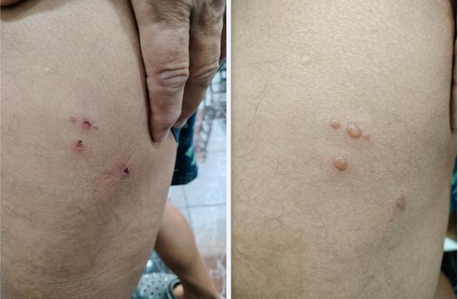 Narcopesquers: els altres vaixells que atraquen a les Canàries amb perill sanitari a bord