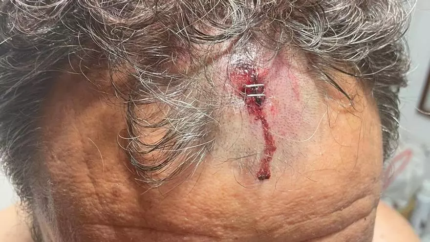 Una denuncia por una agresión en un bar propicia el cese del director general de Turismo de Extremadura