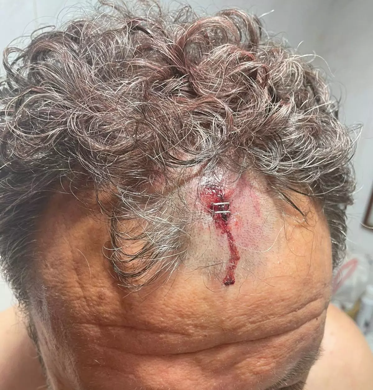Una denuncia por una agresión en un bar propicia el cese del director general de Turismo