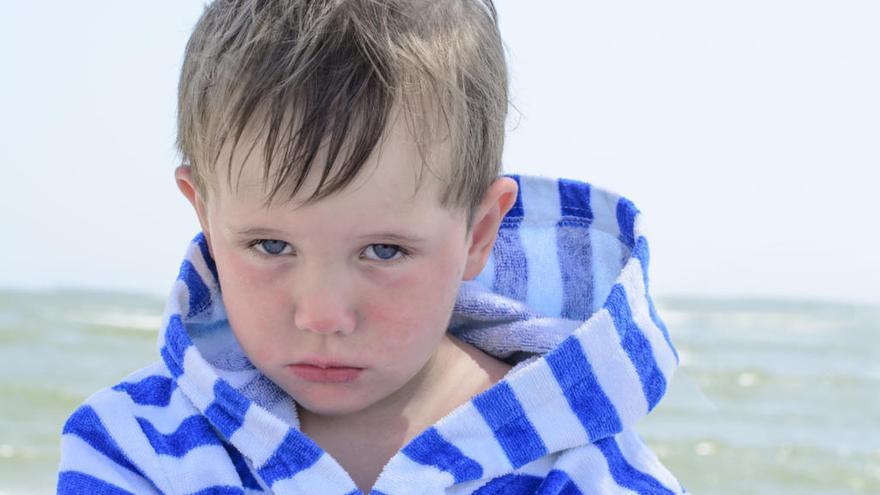 Niño con dermatitis atópica en la playa