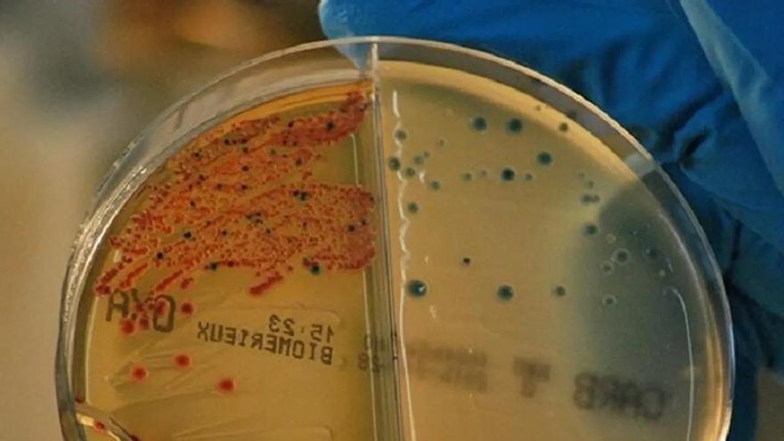Alerta mundial: los ‘supermicrobios’ pueden matar a 10 millones de personas al año