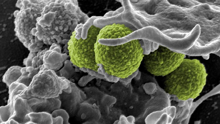 Staphylococcus aureus: así es la bacteria resistente que tanta guerra puede dar en los pies