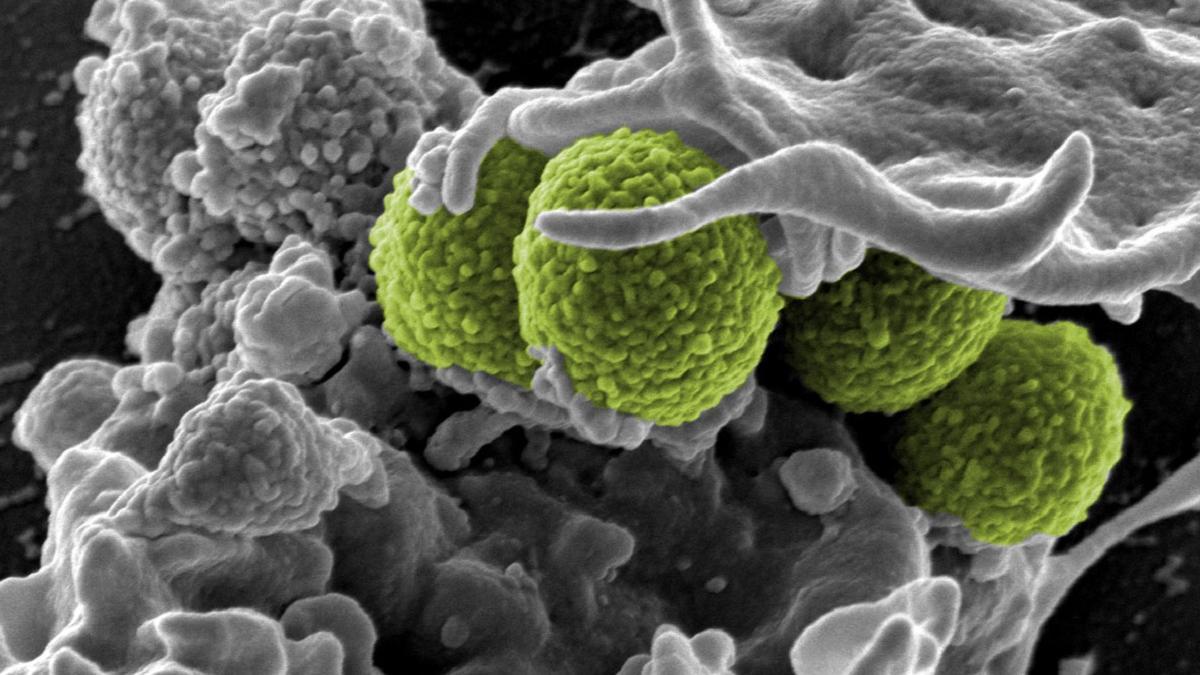 Staphylococcus aureus: la bacteria resistente que puede infectar los pies.