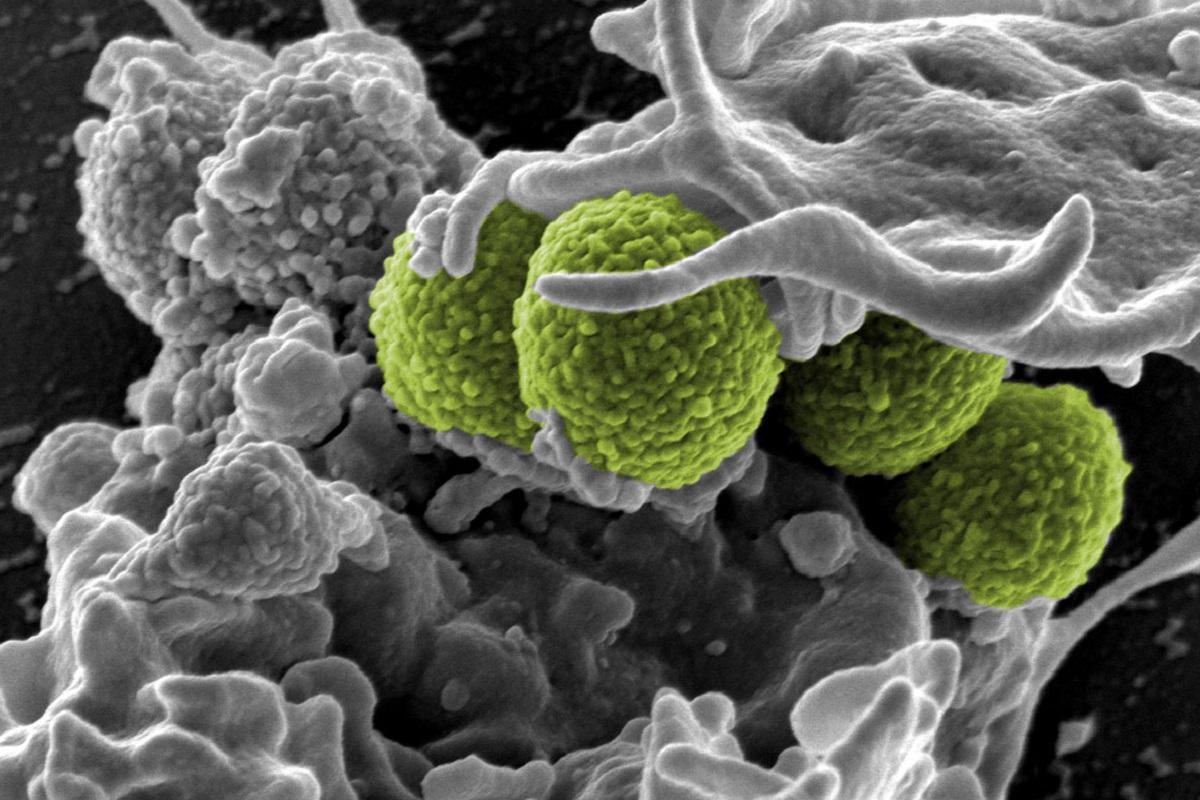 Staphylococcus aureus: la bacteria resistente que puede infectar los pies.