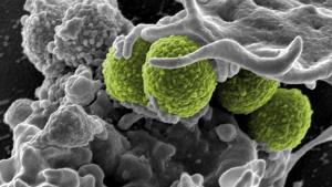 Staphylococcus aureus: la bacteria resistente que puede infectar los pies.