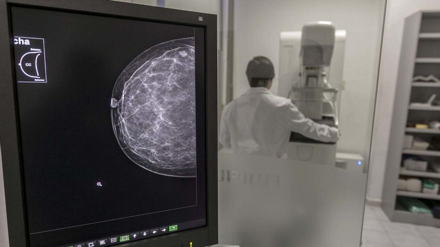 Un médico usando un mamógrafo en una consulta del centro de salud de Altabix.  | ANTONIO AMORÓS