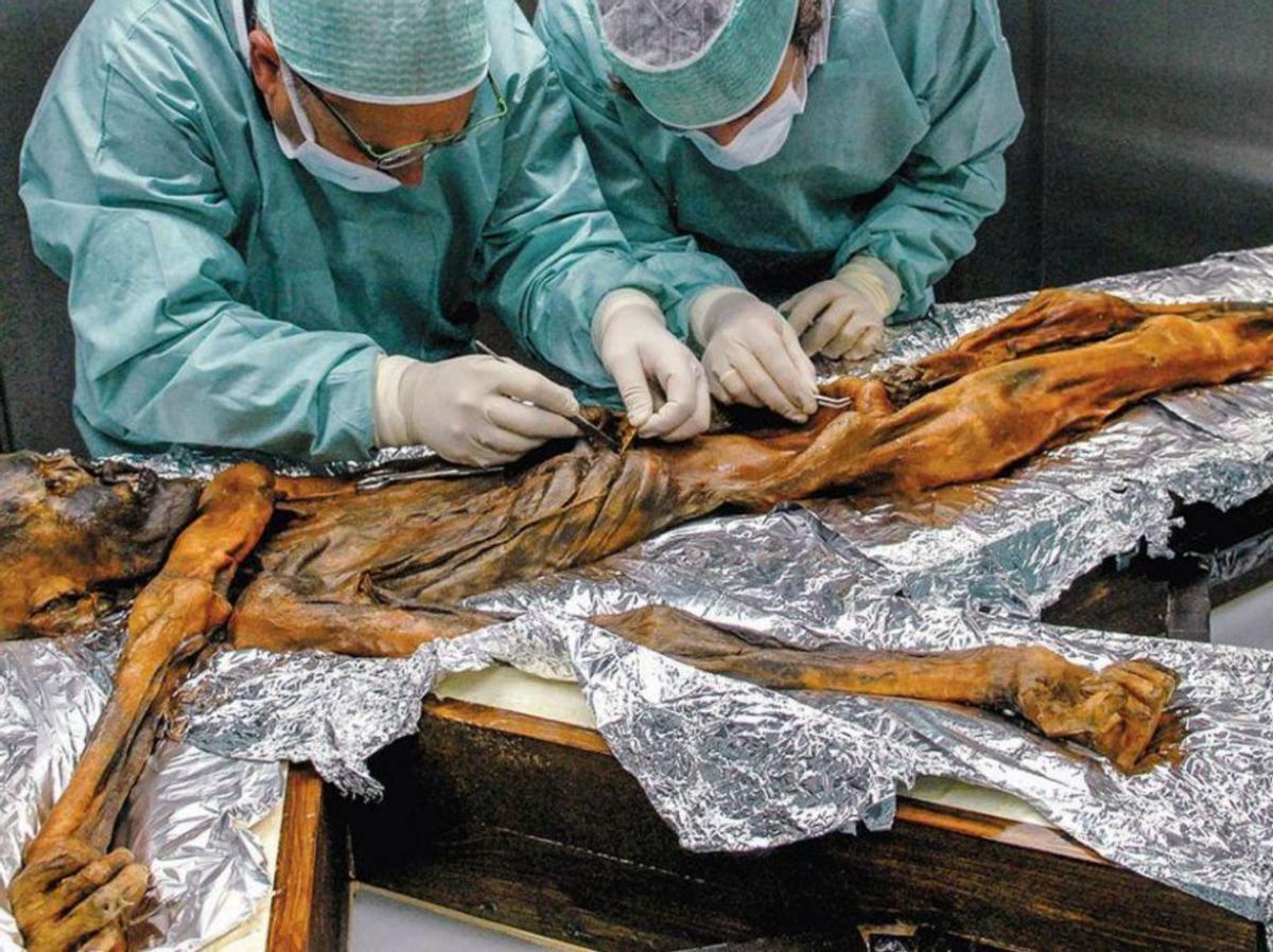 Investigadores analizan el cuerpo momificado de Ötzi.