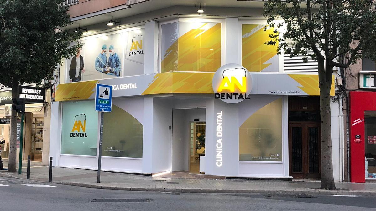 Limpieza bucal en la clínica de Elche AN Dental