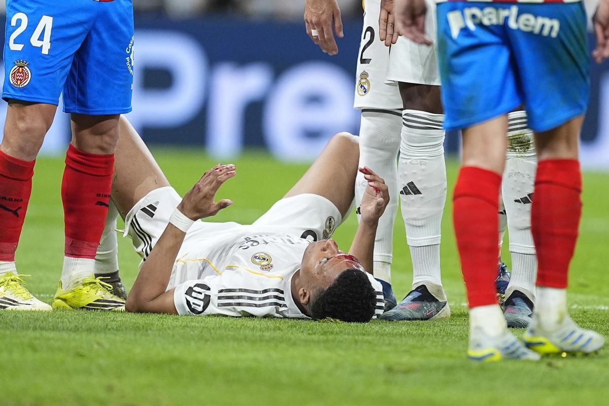 Mbappé, tendido sobre el césped con sangre en la cara tras la acción polémica del Real Madrid-Girona.