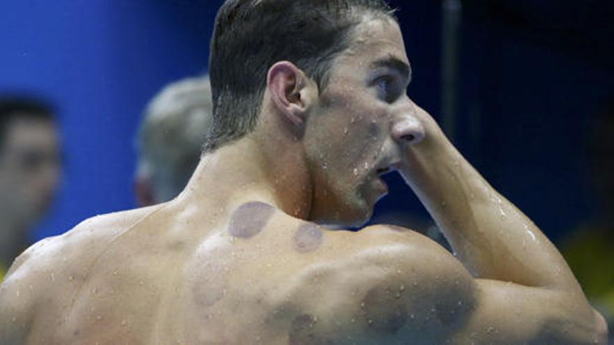 ¿Qué son los moratones que tiene Phelps en la espalda?