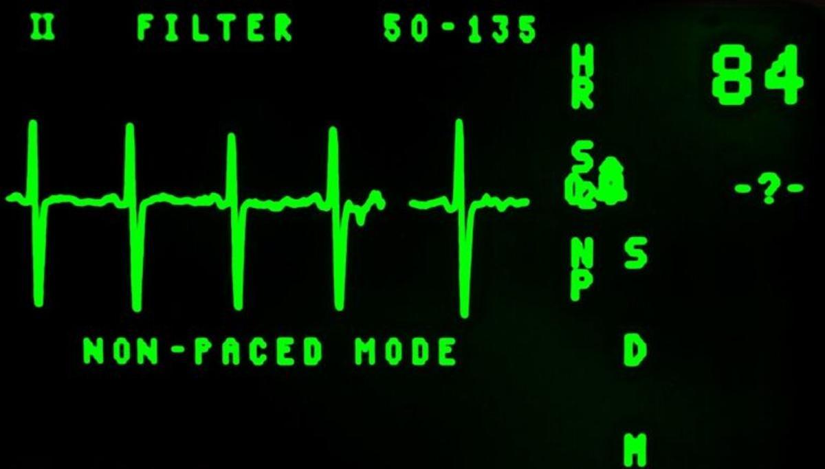 La vacuna del coronavirus también está recomendada en pacientes tratados con Sintrom