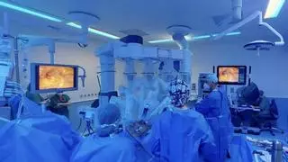 El Santa Lucía realiza alcanza las 150 cirugías urológicas con el robot Da Vinci en pacientes con cáncer
