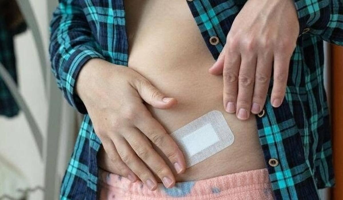 Parches de testosterona.