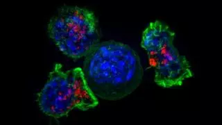 Terapia de células CAR-T: el eficaz tratamiento para el cáncer de sangre que sigue sin llegar a todos