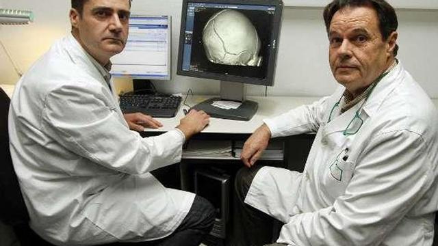 Vázquez Castelo (izq.) y Vieito muestran un tac craneal. // Jorge Santomé