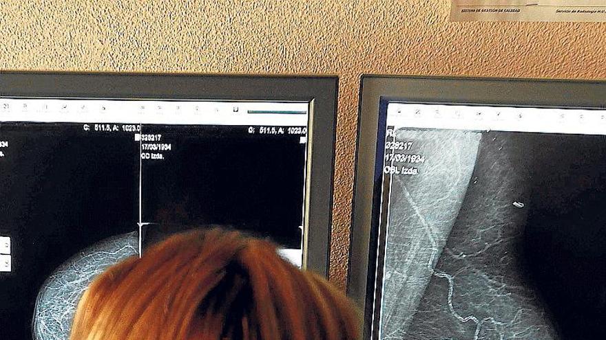 Una radióloga explora una mamografía en el Hospital de Sant Joan.