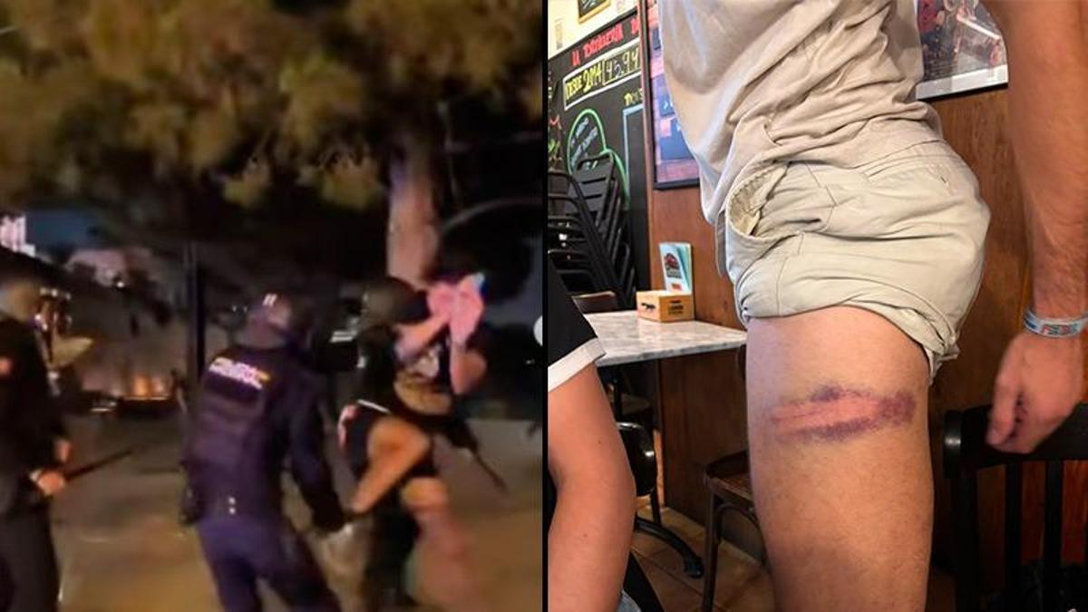 A la izquierda, una captura de pantalla del vídeo en el que los policías aporrean a Biel Garau. A la derecha, una de las marcas de las contusiones que ha sufrido.
