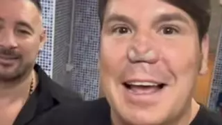 La nueva imagen de Lucas de Andy y Lucas vuelve a sorprender: así está ahora su nariz