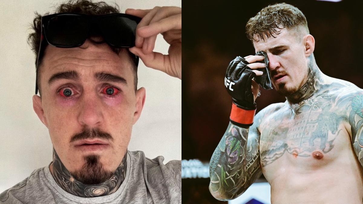 Tom Aspinall, campeón de la UFC, tras su doble operación en los ojos: “Me mareo y siento como si estuviera en un barco”