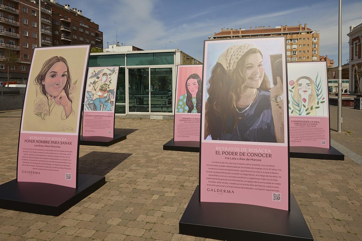 Retratos de la rosácea