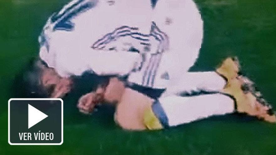 Van Persie, cerca de perder  su ojo izquierdo por un codazo