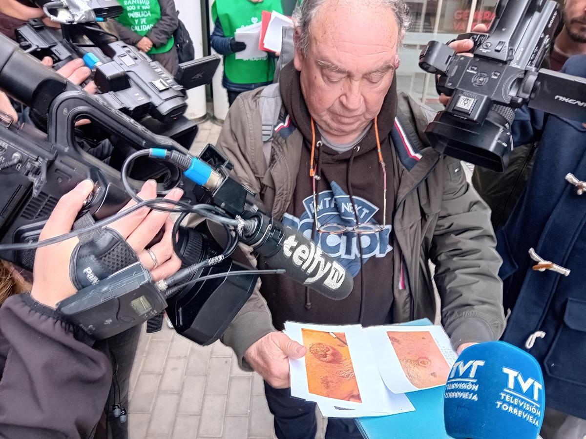 El paciente muestra fotos de la evolución de su lesión