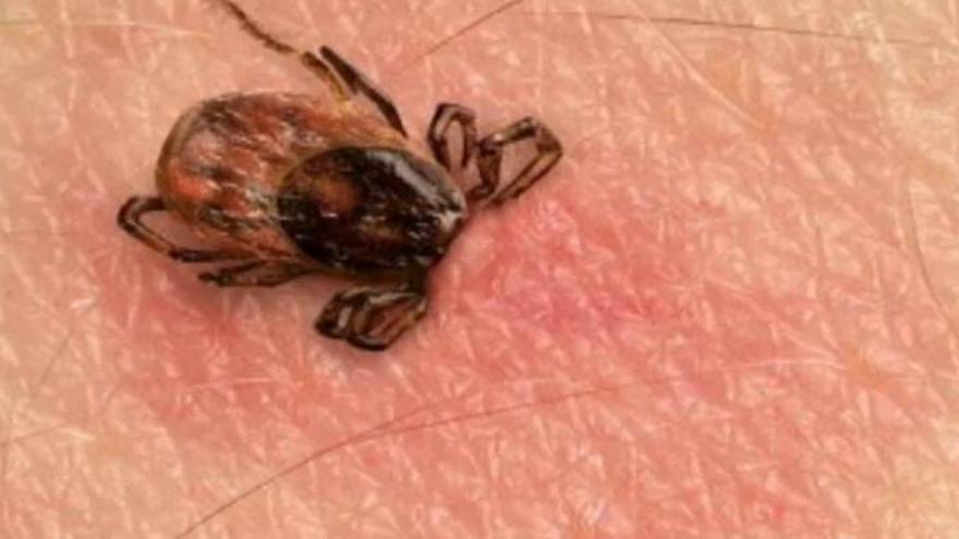 Solo garrapatas infectadas pueden transmitir el virus de la fiebre hemorrágica