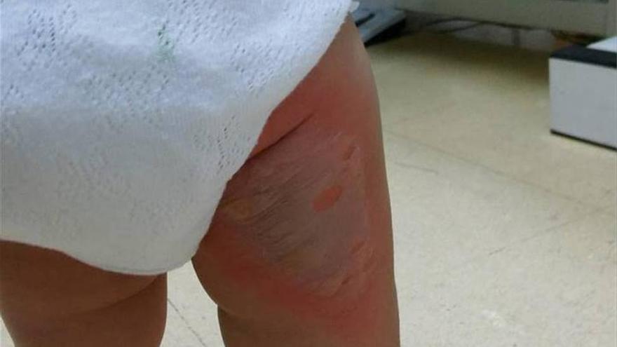 Una niña sufre quemaduras en la pierna causadas por un foco en una plaza de  Villanueva - El Periódico Extremadura